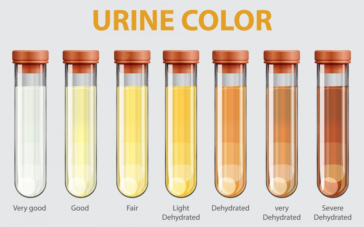 warna urine